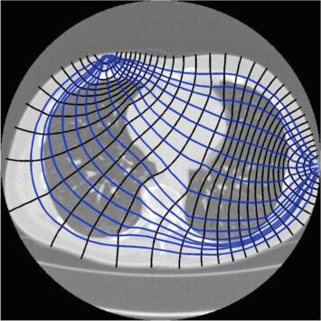 Geometry of impedance measurements